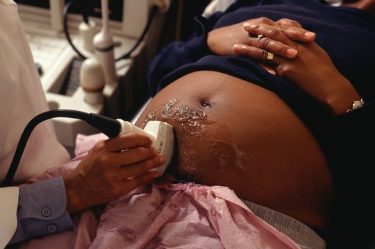 HUNDRED NEWBORNS DIE EVERY WEEK IN ZAMBIA – MASEBO