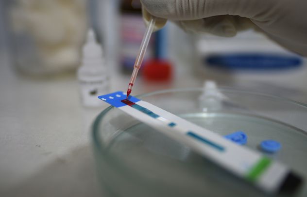 NEW HIV VARIANT WITH HIGHER VIRULENCE AND MORE DAMAGING HEALTH IMPACTS DISCOVERED IN THE NETHERLANDS.