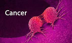 ZAMBIA RECORDS 300 CANCER CASES IN CHILDREN ANNUALLY