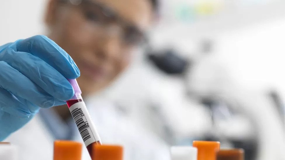 Stigma around HIV continues to cause harm, says charity