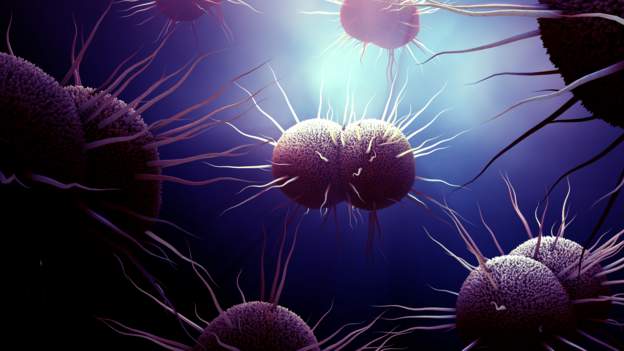 Drug-resistant gonorrhoea strain detected in Nairobi